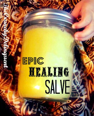 How to Make an Epic Healing Salve