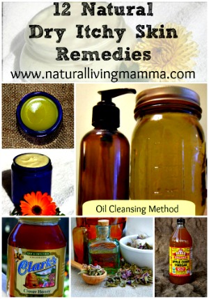 12 Natural Dry Itchy Skin Remedies & Recipes