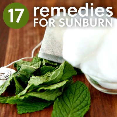 17 Natural Remedies for Sunburn