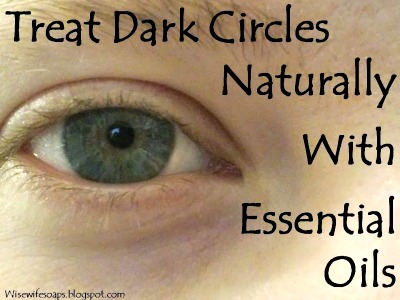 All Natural Essential Oil Treatment for Dark Circles 
