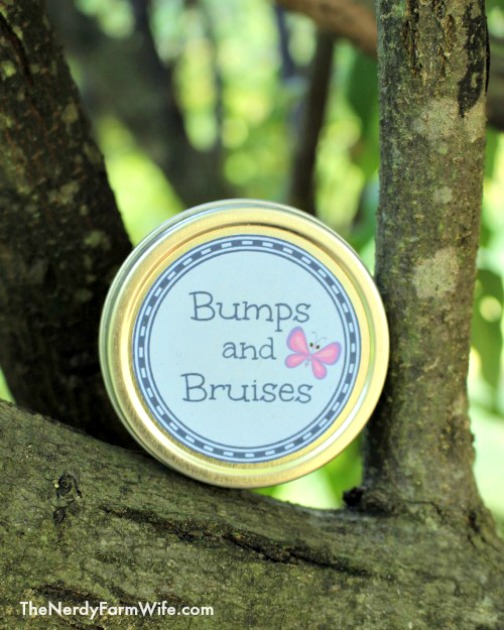 Homemade Bumps and Bruises Balm