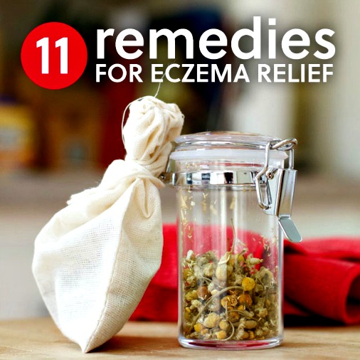 11 Healing Home Remedies for Eczema 1