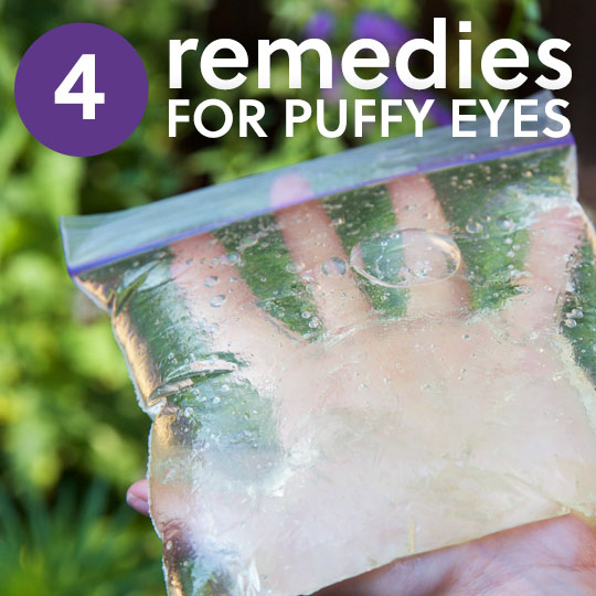4 Remedies for Puffy Eyes