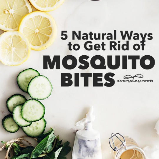 5 Natural Ways to Get Rid of Mosquito Bites | Everyday Roots