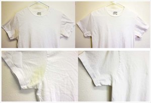Goodbye to Yellow Armpit Stains