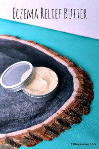 best homemade eczema remedy